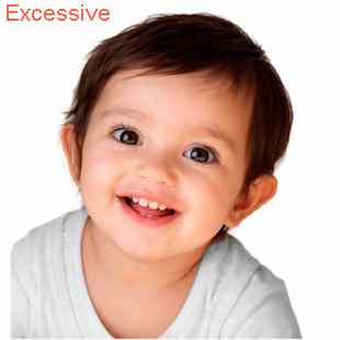 baby Excessive
